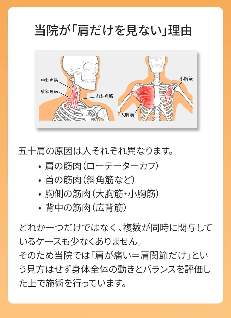 五十肩の原因は人それぞれ異なります。当院では、肩が痛い＝肩関節だけを見ることはしません。