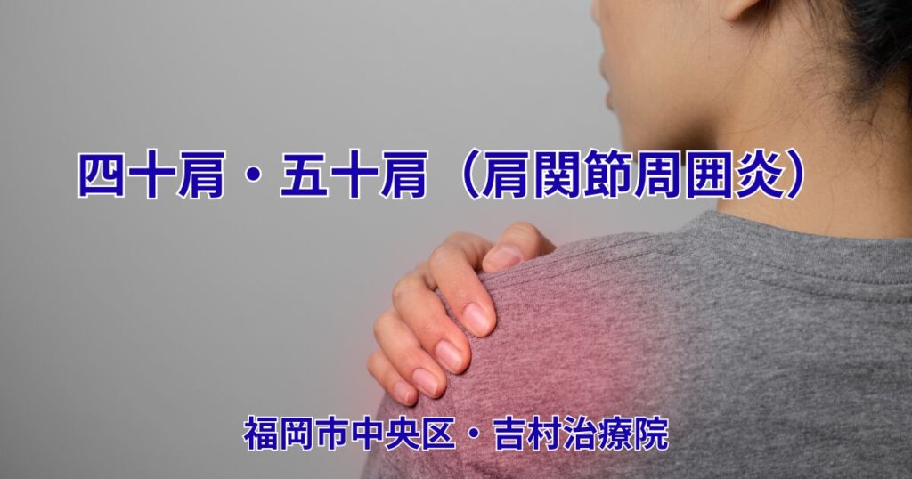 四十肩・五十肩(肩関節周囲炎)で肩の痛みに悩む女性