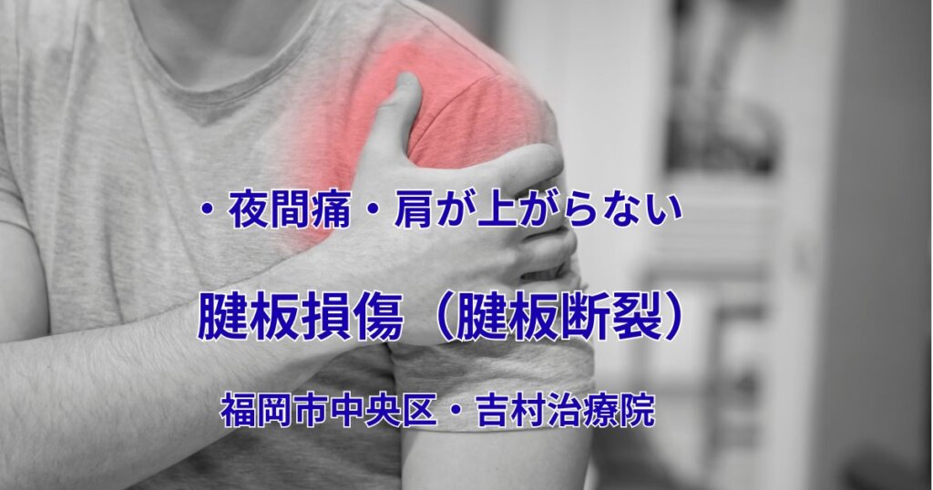 肩の前側を押さえて痛みを訴える男性。腱板損傷（腱板断裂）の症状を表したイメージ。福岡市中央区 吉村治療院