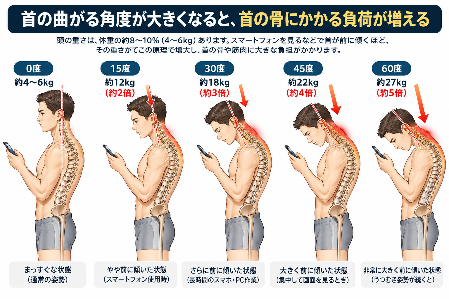 首が前に傾く角度が大きくなるほど、首の骨にかかる負担が増える。0度で約4〜6kg、15度で約12kg、60度で約27kg